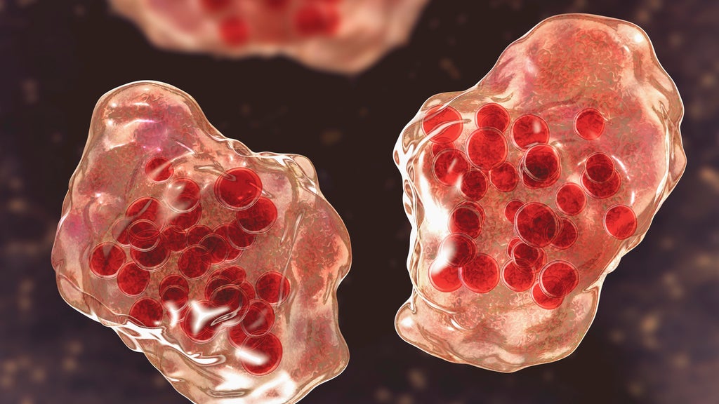 Central Minnesota county reports "several cases of suspected measles" — WCCO / CBS Minnesota, Bloomington Health news
