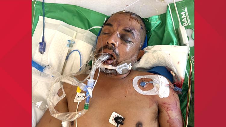 University Hospital asks for help identifying unconscious patient hit by truck Saturday evening — KENS 5 (San Antonio), Bloomington Health news