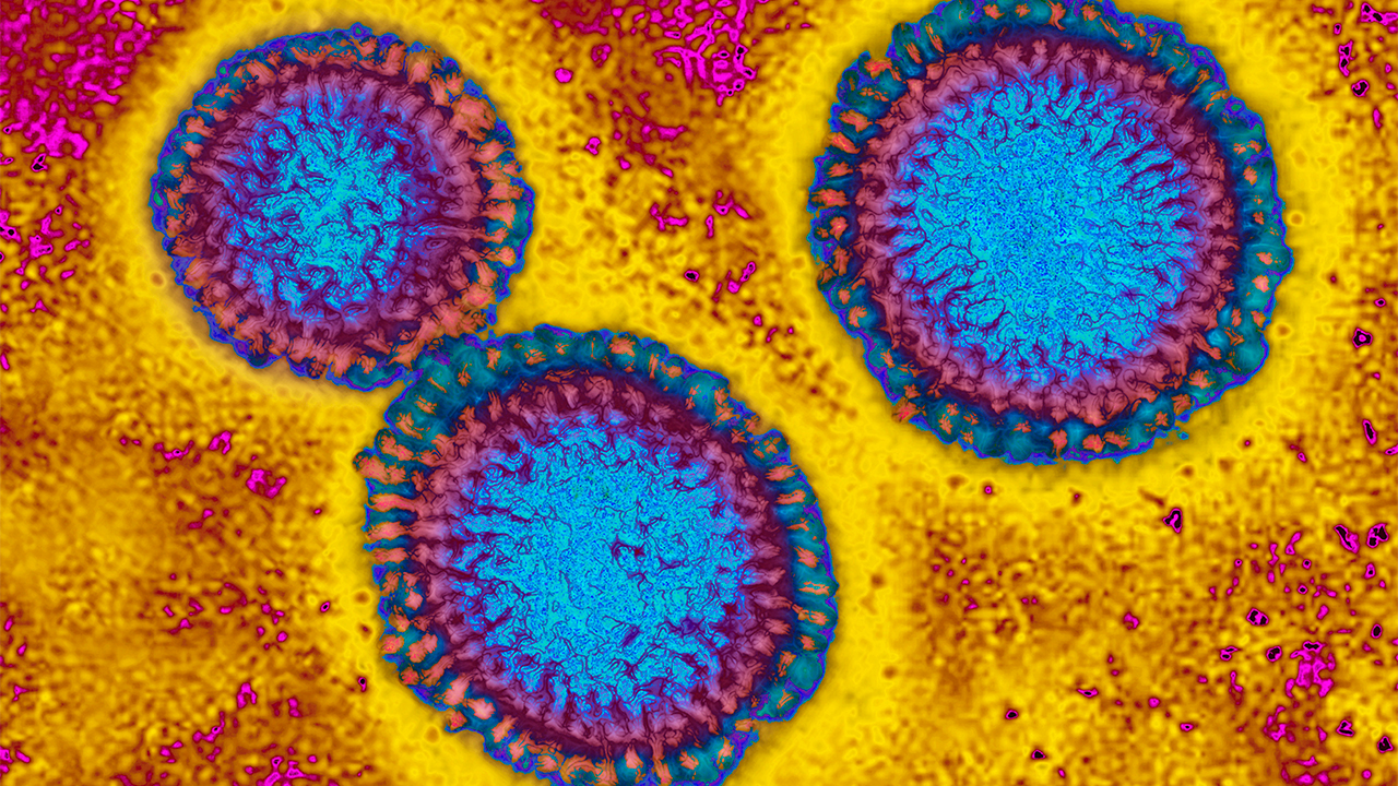 Flu hospitalizations 'slightly higher' than usual, officials urge vaccinations — FOX 9, Bloomington Health news
